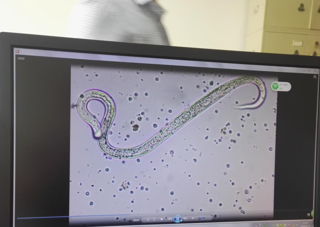 显微镜下根结线虫检测