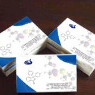 人抗信号识别颗粒抗体试剂盒 SRP试剂盒 抗信号识别颗粒抗体ELISA试剂盒 厂家直销图片