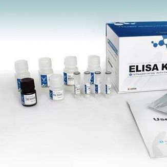 人性素结合球蛋白试剂盒 SHBG试剂盒 性素结合球蛋白ELISA试剂盒 厂家直销图片
