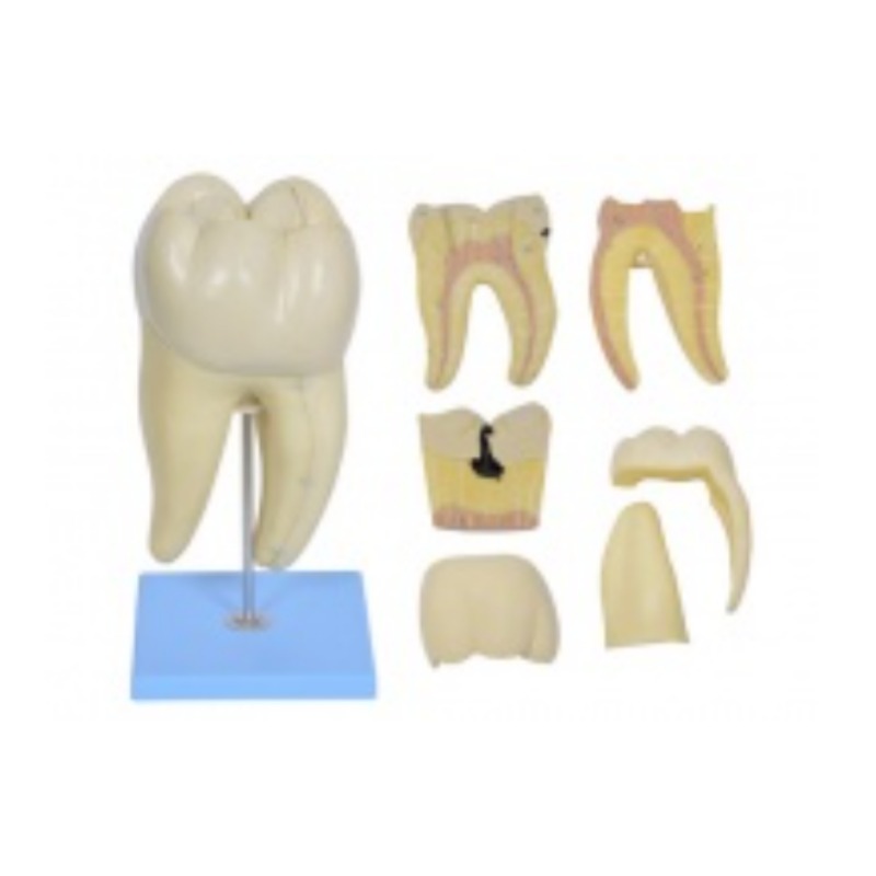 右侧一下磨牙蛀牙模型实训考核装置  右侧一下磨牙蛀牙模型实训设备  右侧一下磨牙蛀牙模型综合实训台图片