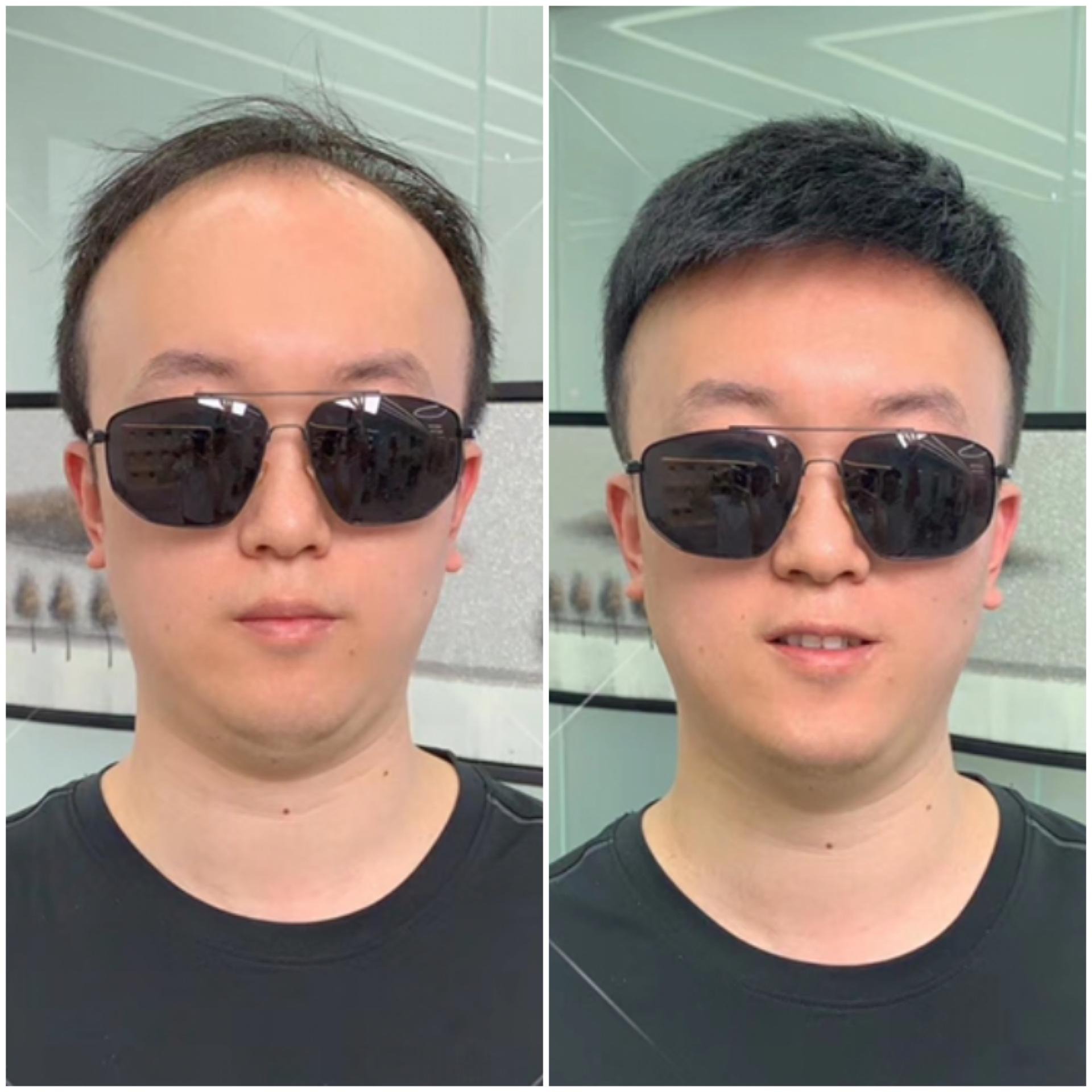 惠州假发 无痕补发增发 男士假发片  量头定做图片