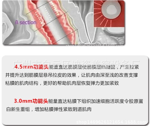 韩国进口美容仪器私密超声刀 女性私密护理紧致美阴仪新品示例图8