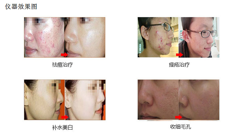 进口韩国超微小气泡美容仪皮肤管理补水美白嫩肤吸黑头面部护理仪示例图3