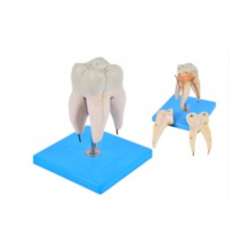 三个牙根下颚磨牙模型实训考核装置  三个牙根下颚磨牙模型实训设备  三个牙根下颚磨牙模型综合实训台图片